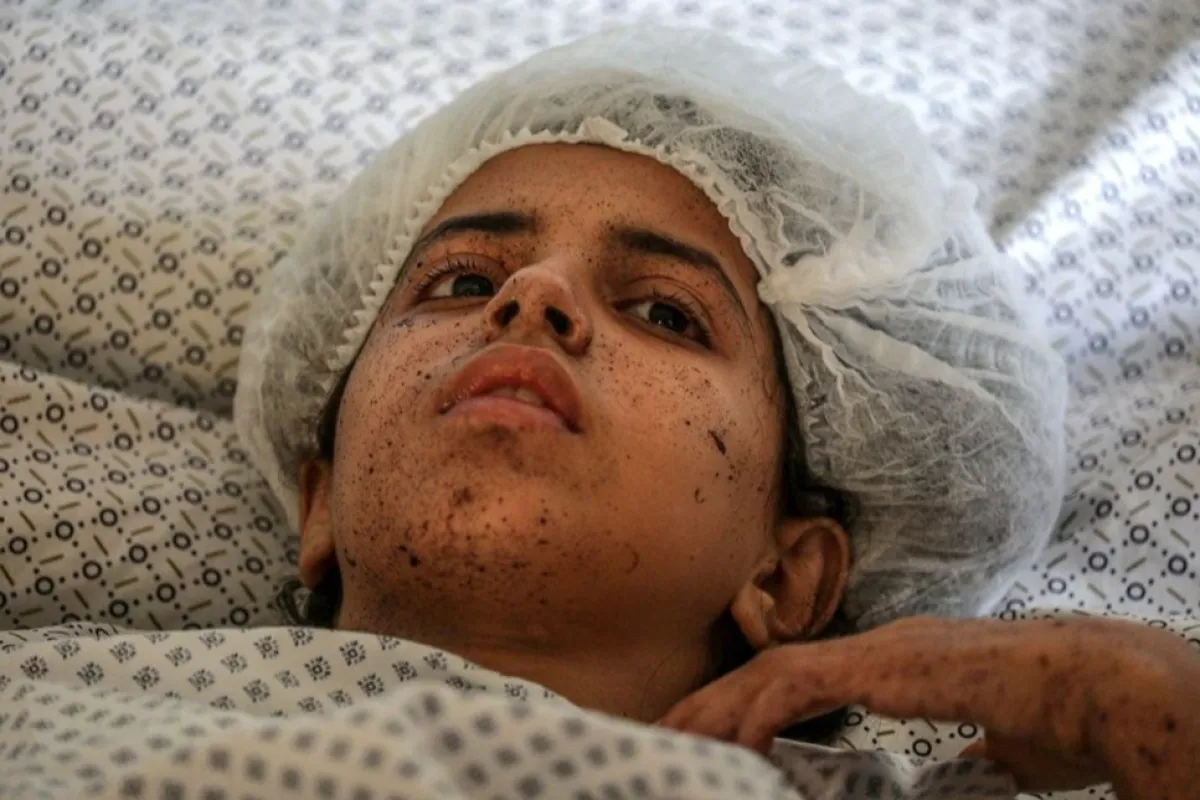 Cel puțin „12 pacienți și rude ale acestora” au fost uciși și câteva „zeci răniți” într-un atac israelian asupra spitalului indonezian din nordul orașului Gaza